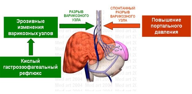 Истоочник: https://protrakt.ru