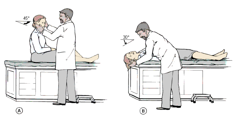 Врач выполняет пробу Дикса-Холлпайка