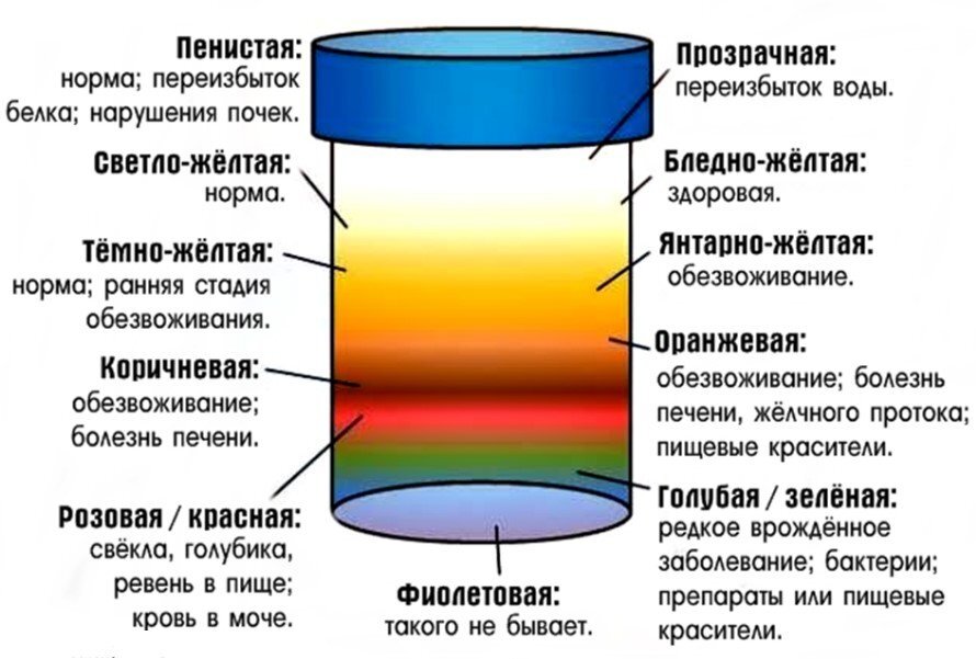 Как понять результаты анализа мочи?