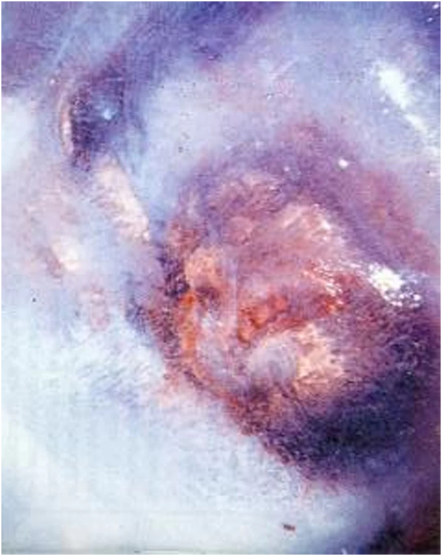 Лицо вмороженного йети