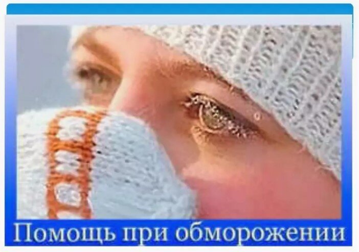Что нужно делать при обморожении?