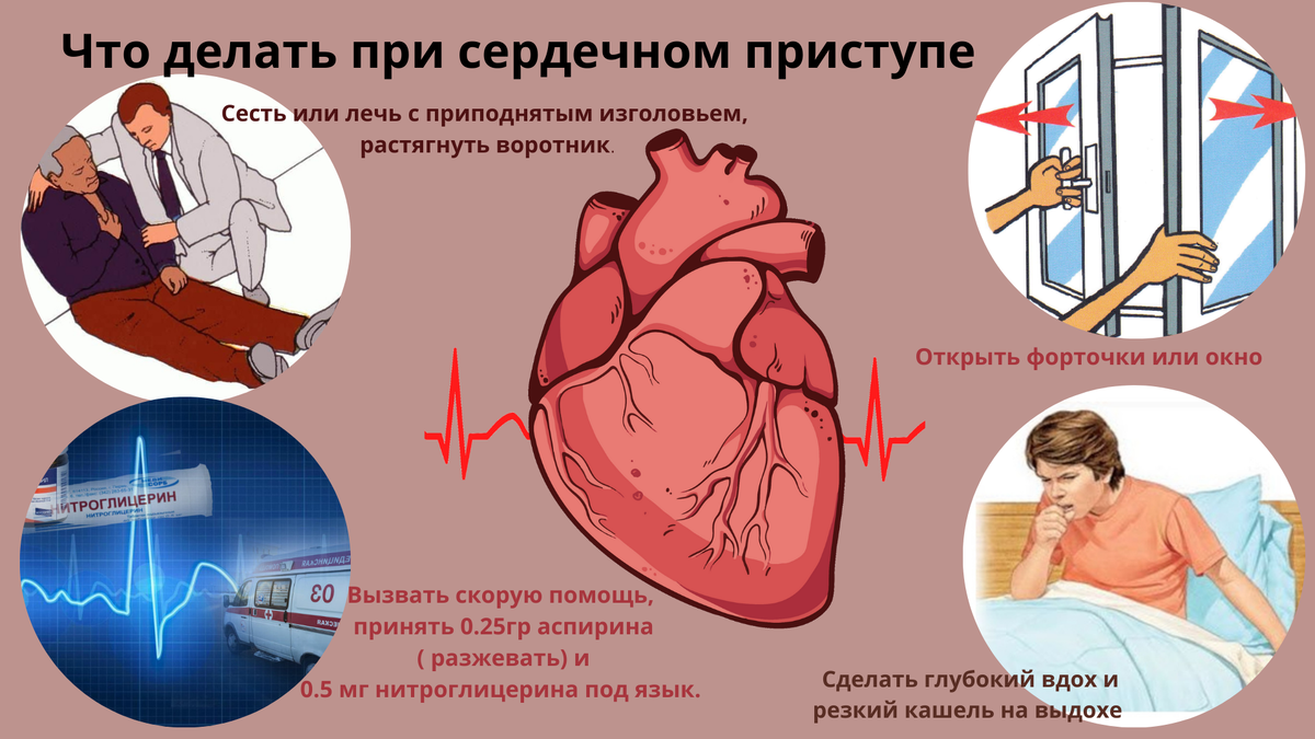 Как спровоцировать сердечный приступ. Сердечный приступ первая помощь.