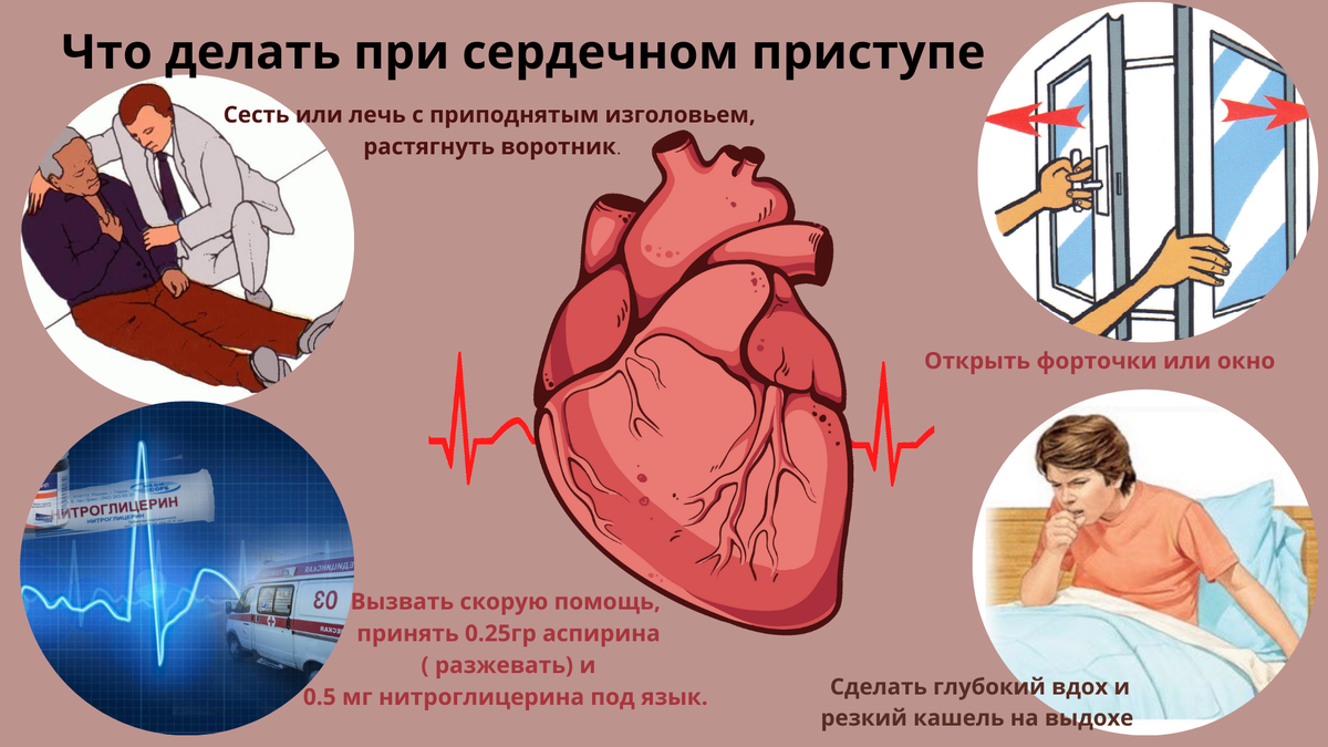 как сделать сердечный приступ в домашних условиях | Дзен