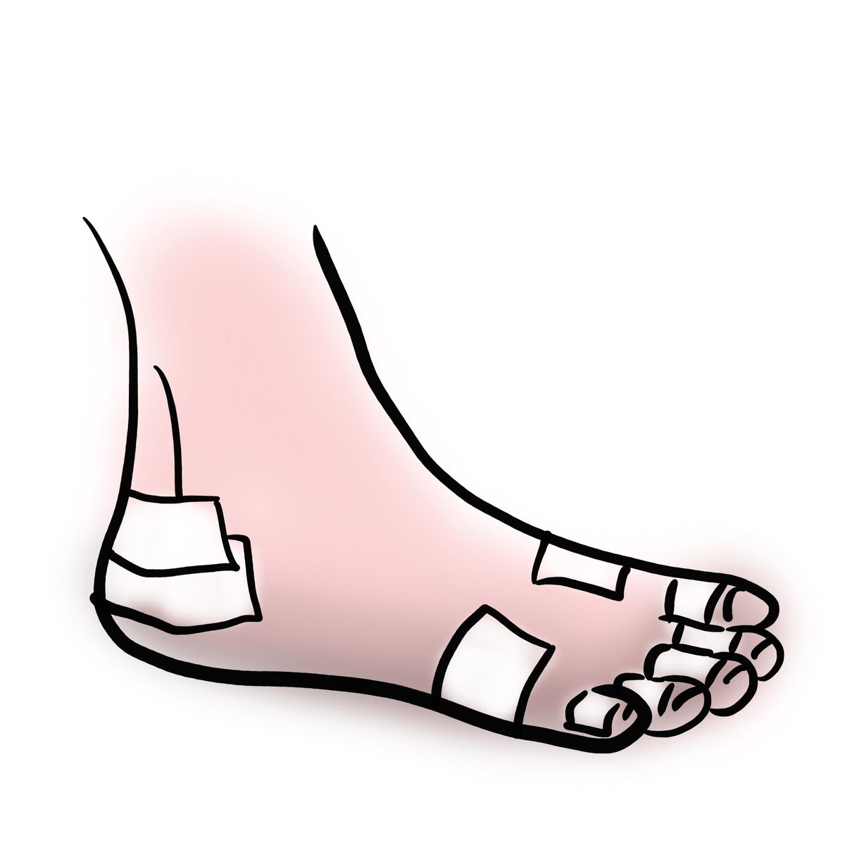 Бумажный пластырь на проблемных местах