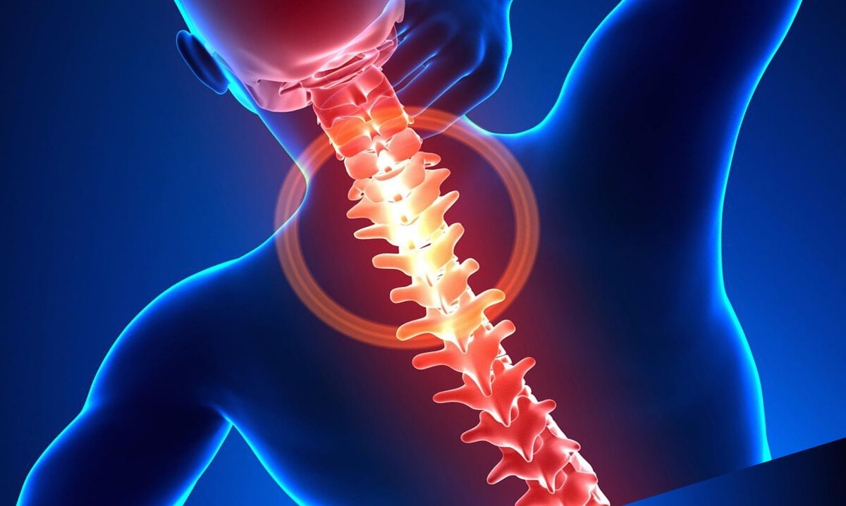 Шейный хондроз симптомы. Остин хондроз. Шейный хондроз. Хондроз позвоночника. Хондроз грудного отдела.