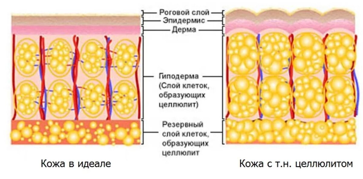 Фото взято в качестве иллюстрации у Яндекс-картинки 