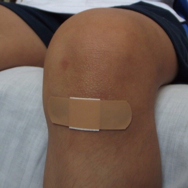 Фото от https://cdn.pixabay.com/photo/2013/04/22/01/13/wound-106374_960_720.jpg