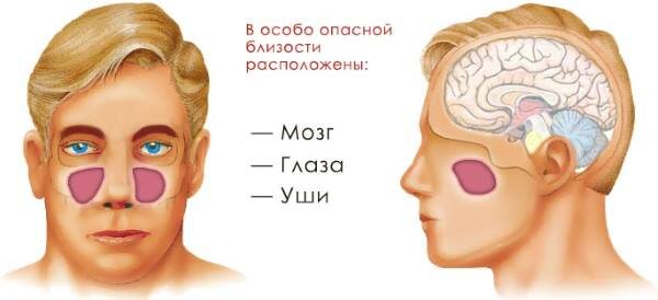 Лечение гайморита народными средствами в домашних условиях: методы