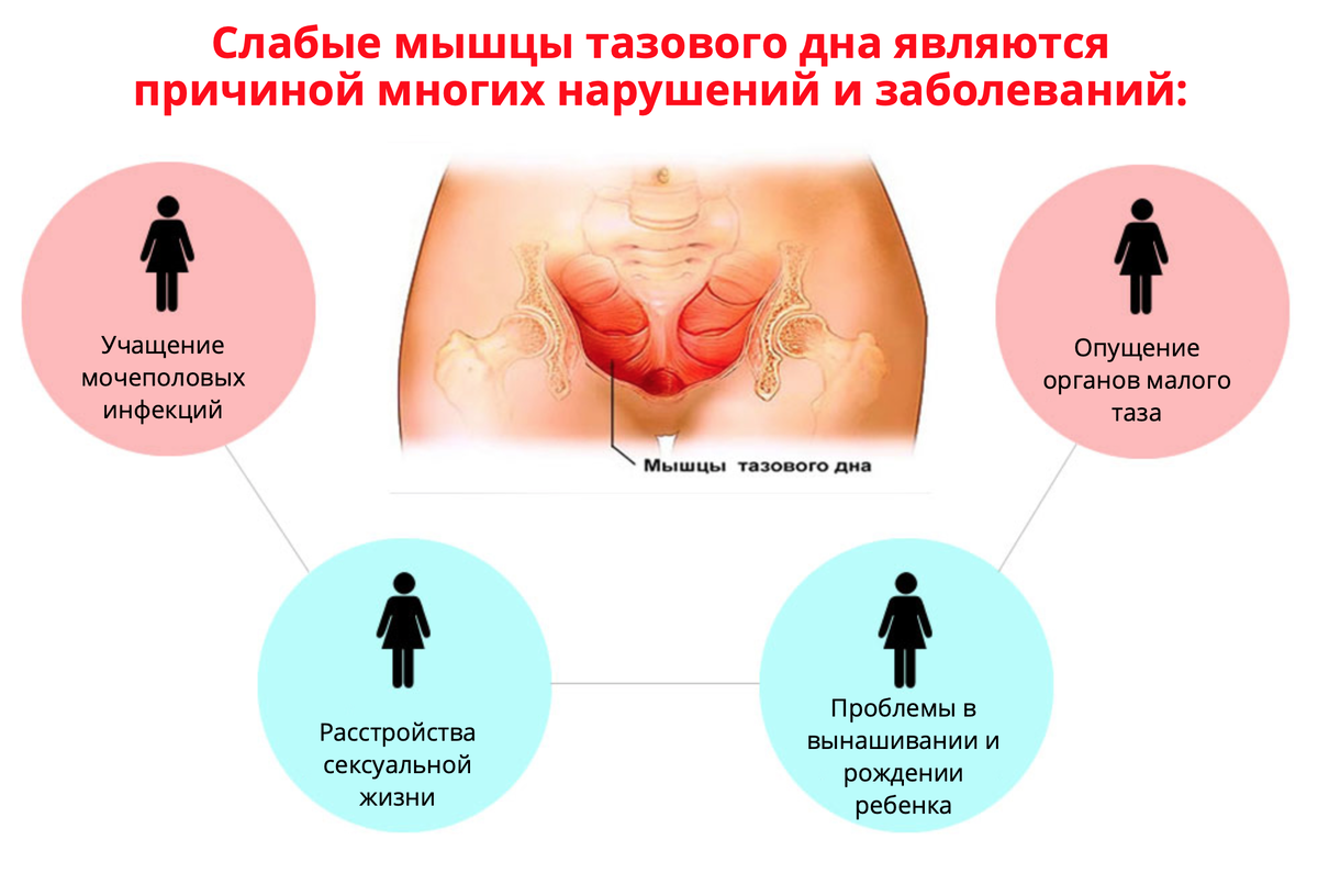 По статистике у каждой 5-ой женщины наблюдается синдром НМ/Фото Яндекс.Картинки