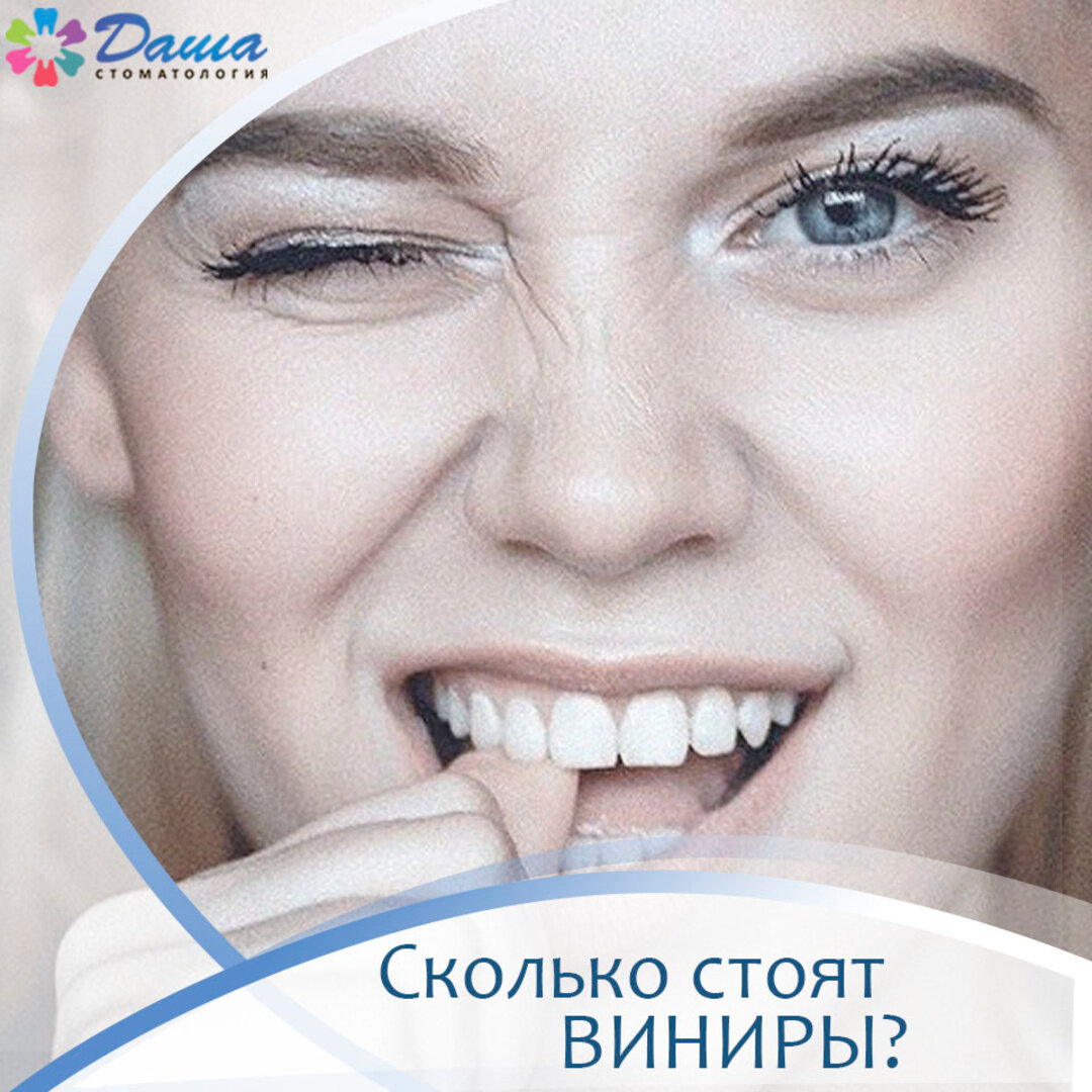 Керамические виниры сделают вашу улыбку идеальной!