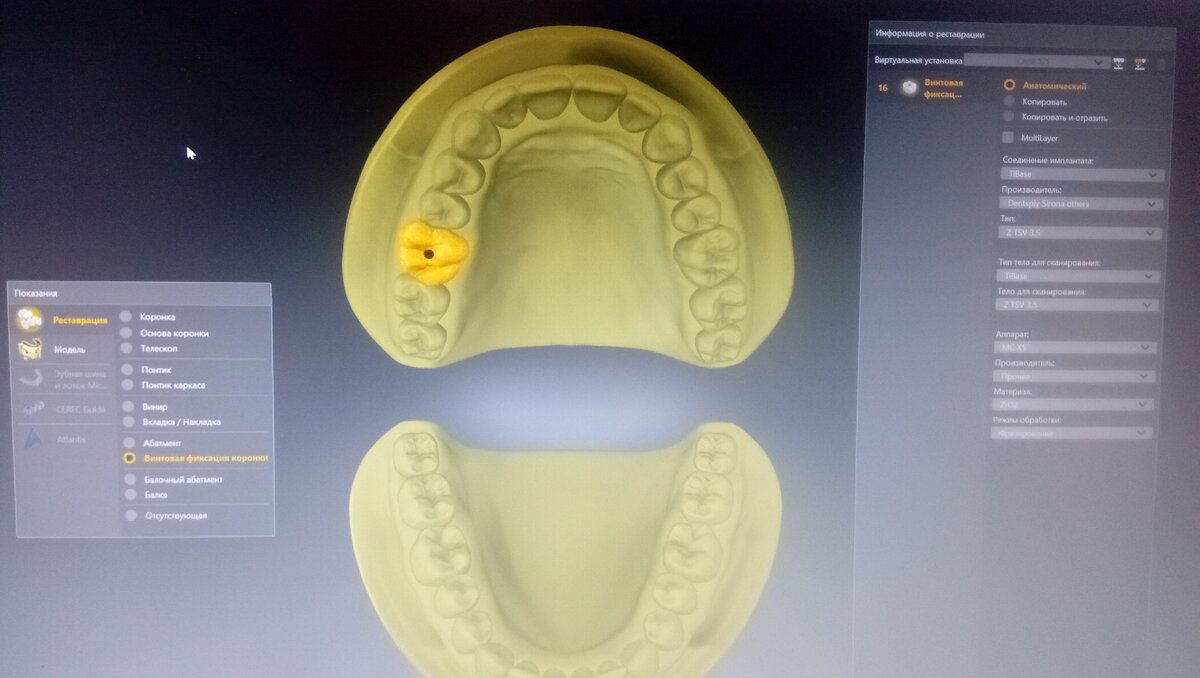 Управление