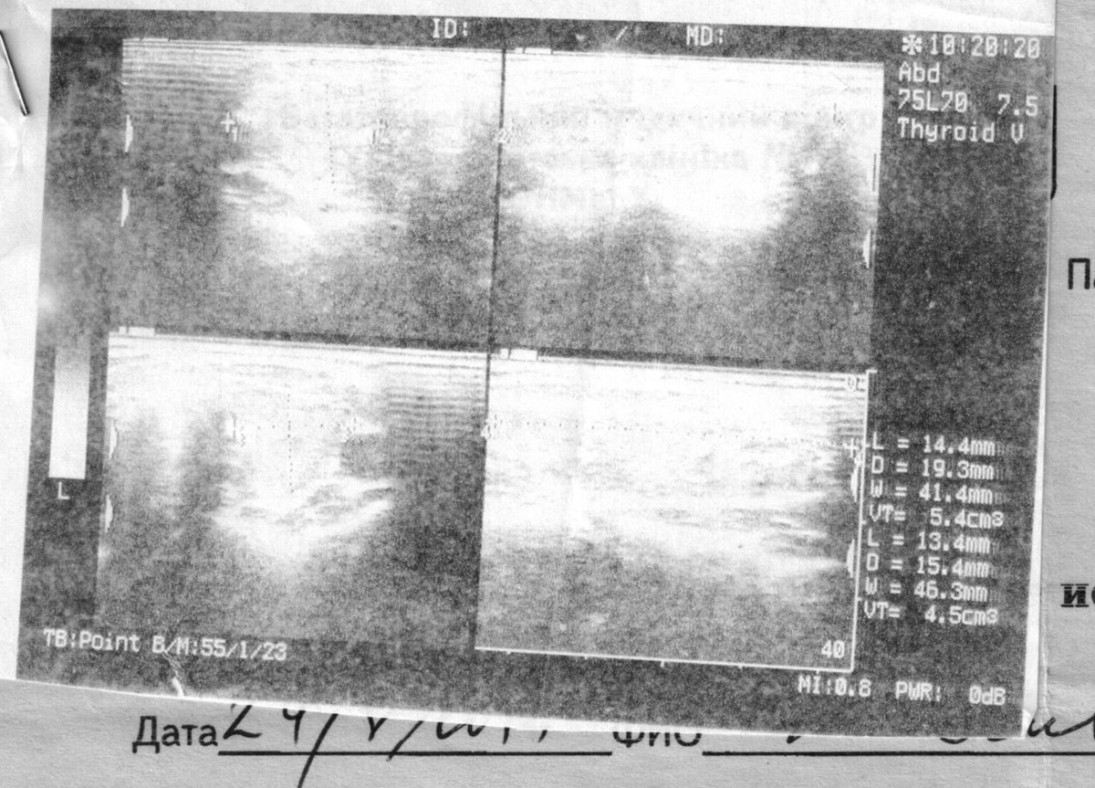 Очень неинформативный снимок УЗИ.