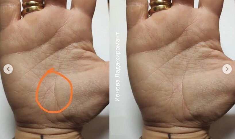 Линия здоровья на руке фото с расшифровкой для женщин
