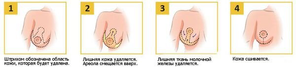 Источник фото: яндекс