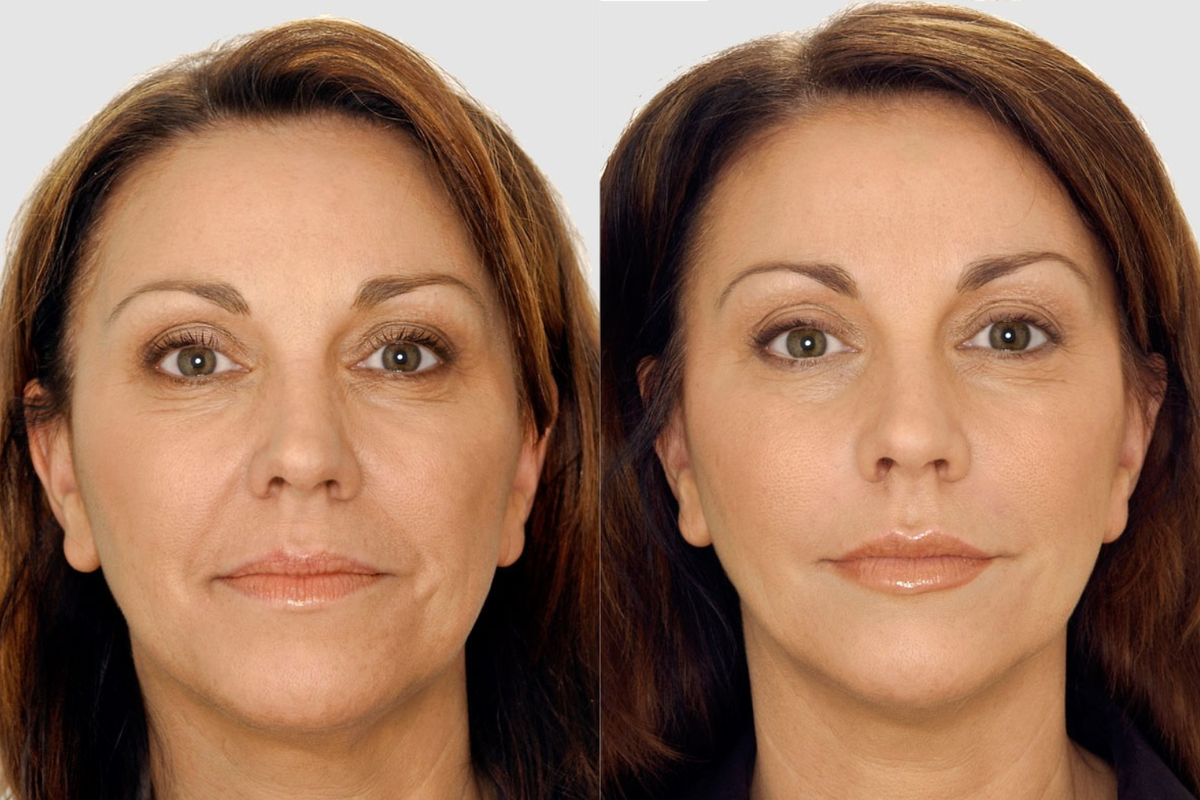 Источник: http://edinstvennaya.ua