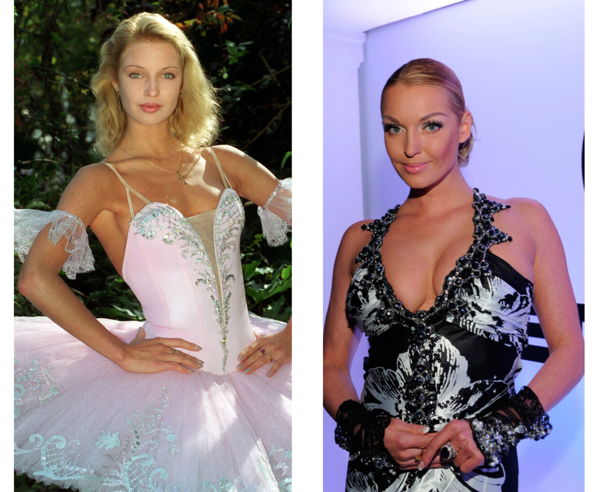 Анастасия Волочкова тогда и сейчас