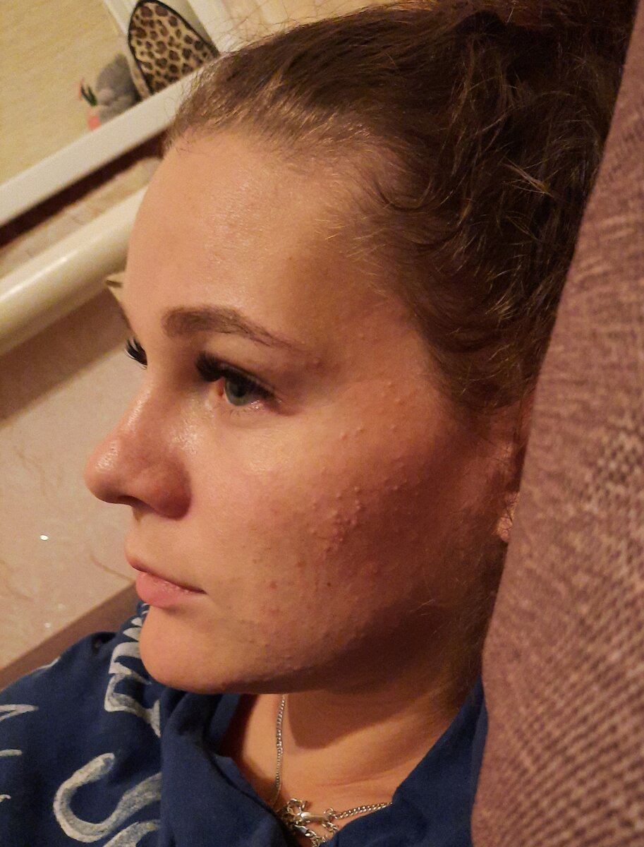 Моя кожа до использования средств ухода