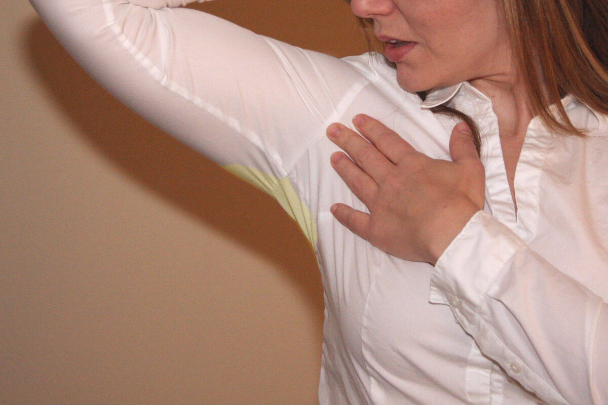 фото с яндекс картинки - https://yandex.ru/images/search?pos=0&img_url=https%3A%2F%2Fwww.polsov.com%2Fupload%2F000%2Fu4%2F132%2F487cffd5.jpg&text=желтизна%20под%20мышками&rpt=simage