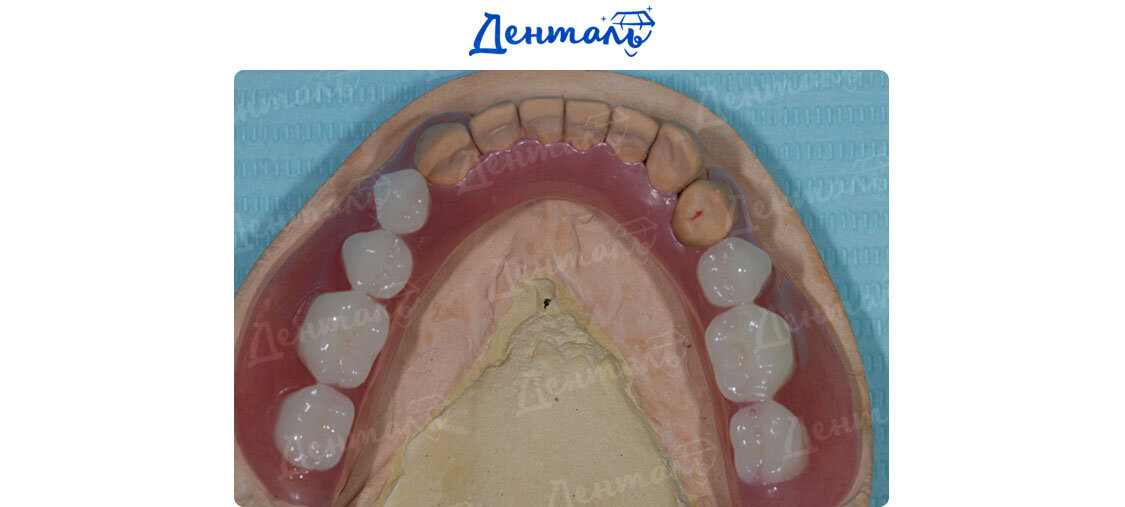 Красивые новые боковые зубы 