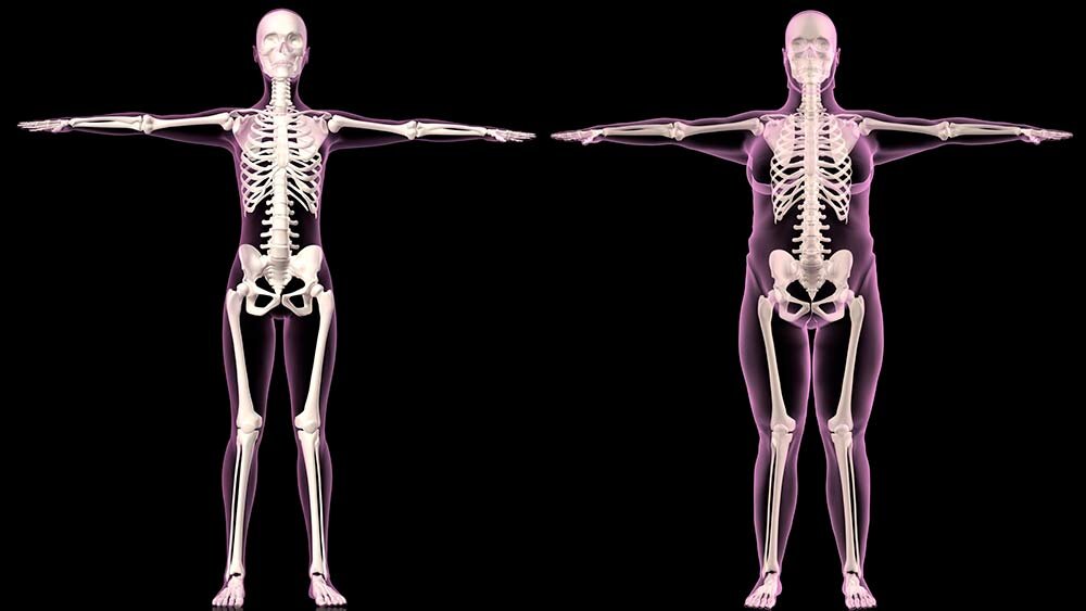 Одинаковые кости. Скелет Толстого человека рентген. Широкий скелет.