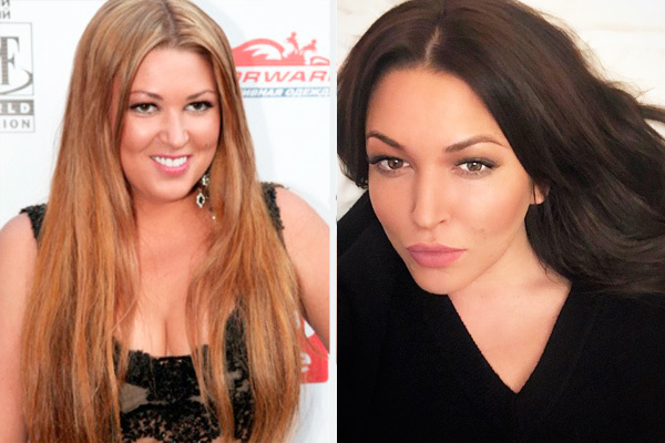 Ира Дубцова и ее пластические операции