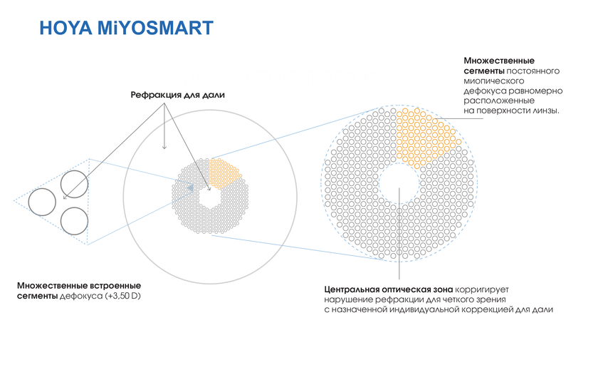 Изображение с сайта https://www.hoyavision.com 