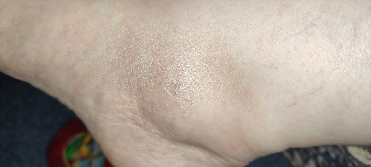 Самое начало. Сделала фото, чтобы рассмотреть получше, что же там случилось. Ничего не видно, как не увеличивала) 