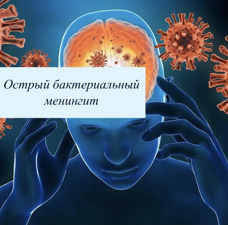 Вич инфекция головного мозга. Инфекция головного мозга. Острый бактериальный артрит.