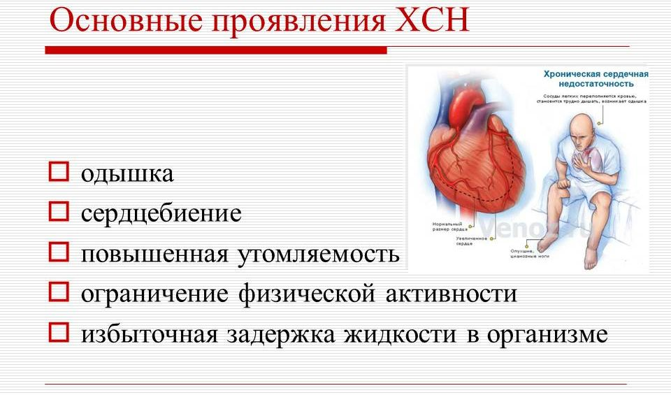 ХСН хроническая сердечная недостаточность симптомы. Терминальная стадия хронической сердечной недостаточности симптомы. Памятки для больных ХСН У больных. Острая и хроническая сердечная недостаточность симптомы.