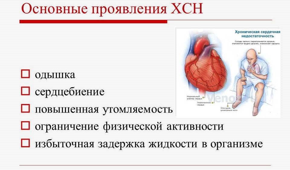 Длительная сердечная недостаточность. ХСН хроническая сердечная недостаточность симптомы. Терминальная стадия хронической сердечной недостаточности симптомы. Памятки для больных ХСН У больных. Острая и хроническая сердечная недостаточность симптомы.