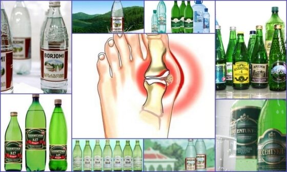 Щелочные минеральные воды полезные для вывода мочевой кислоты.