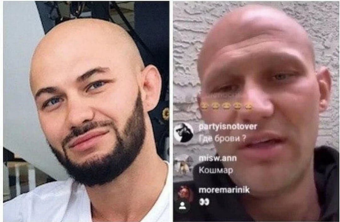 Вот так наркотики меняют людей. Тотальное преображение Джигана.