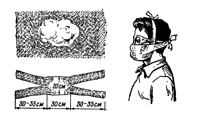 Схема ватно марлевой повязки