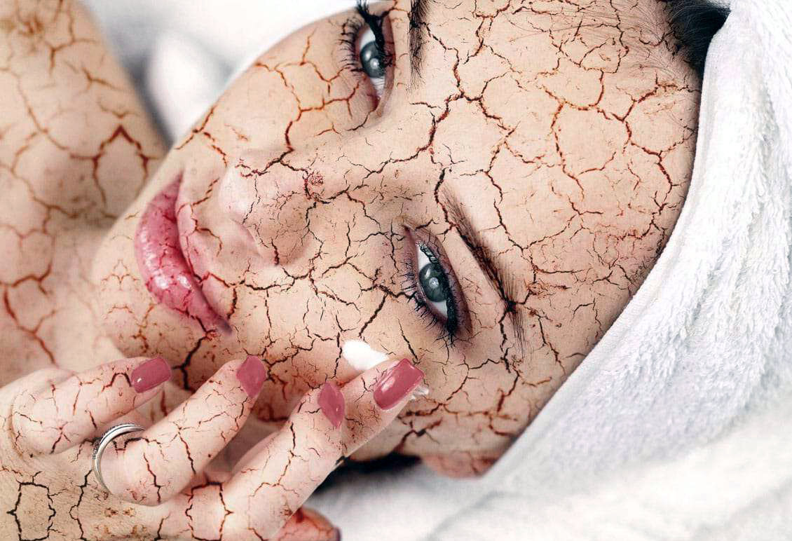 Обезвоженная кожа: стянутость, шелушения, "скатывание" тона, тусклый цвет