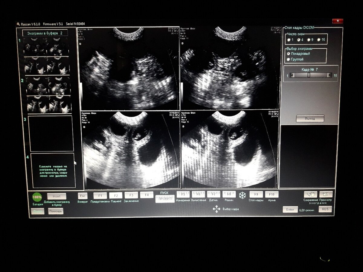 Через месяц в питомнике ожидается рождение щенков добермана. Видимо ,мнооого и точно не два. Источник https://vk.com/arlenrus