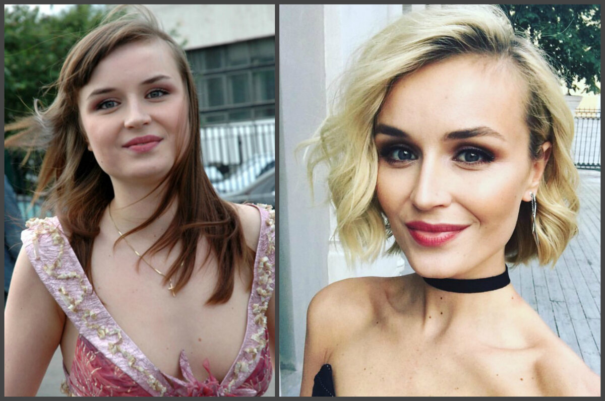 Полина гагарина до похудения и после пластики