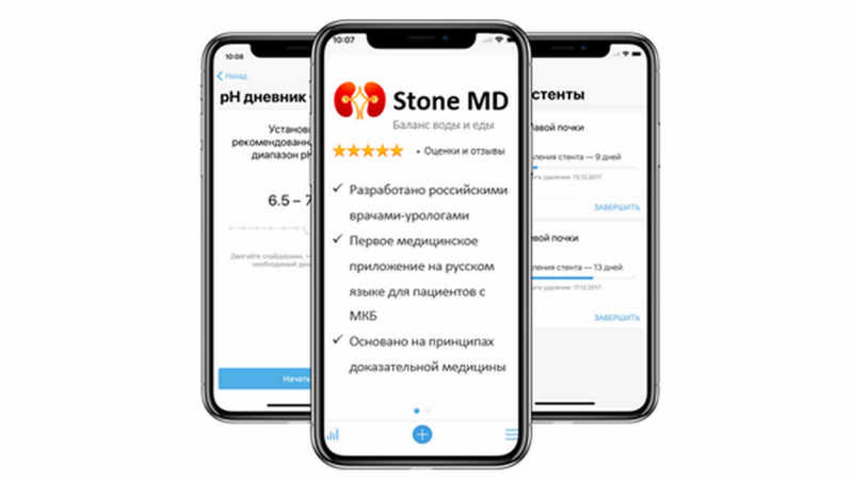Современная профилактика мочекаменной болезни в вашем телефоне 