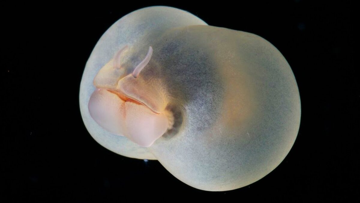 На этом фоне есть ощущение, что червячок сделал себе ботокс)))