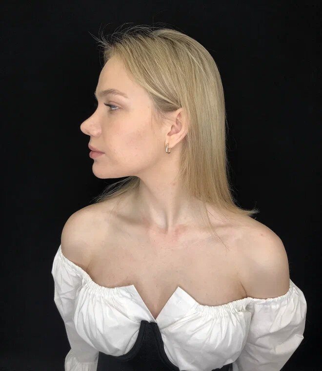 После операции.