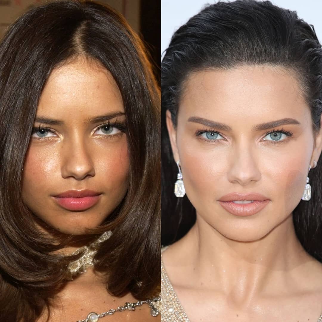 @adrianalima