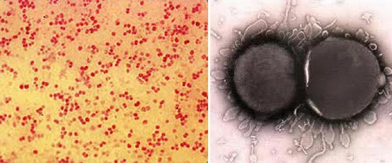 Возбудитель менингококковой инфекции.