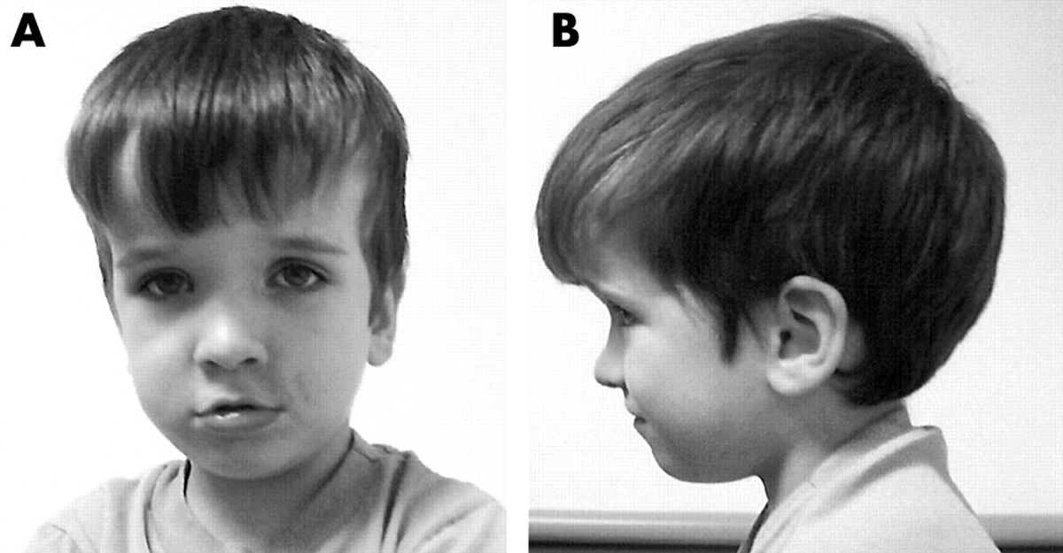 Источник: Journal by Medical Genetics  