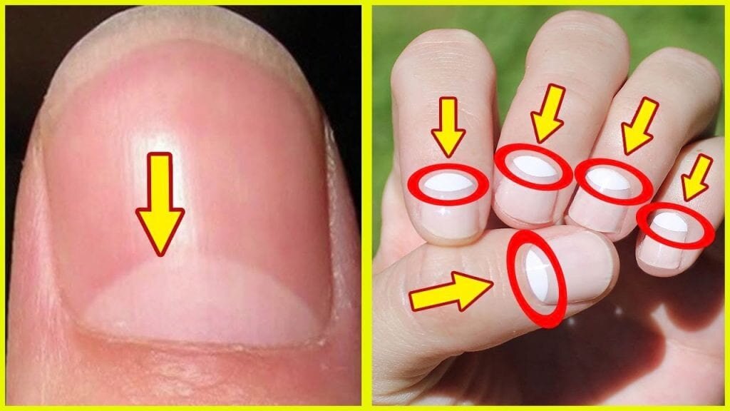 Трещины на ногтях и желтизна - что означают, советы эксперта | Новости РБК Украина