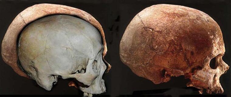 Череп современного человека (слева) по сравнению с черепом кроманьонца (справа)
