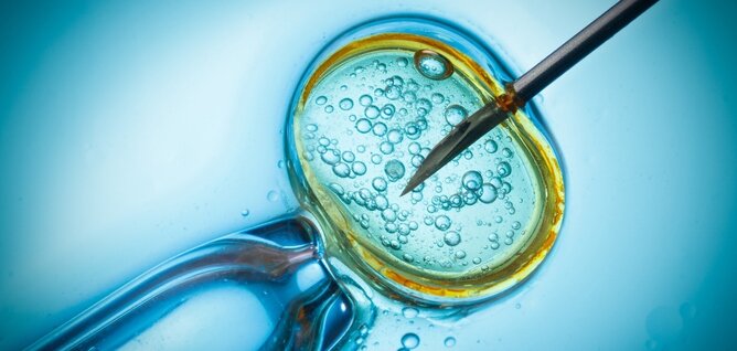 implant-ivf.com