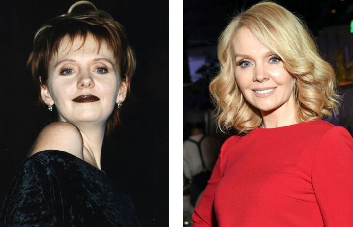 Валерия. До и после.