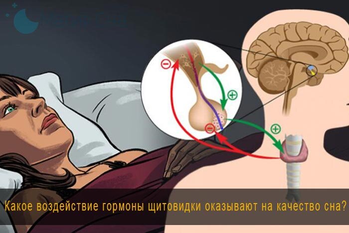 Какое воздействие гормоны щитовидки оказывают на качество сна?