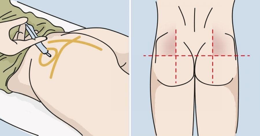 Источник: udipedia.ru