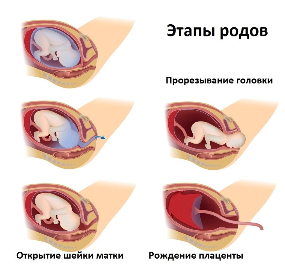 Истмико-цервикальная недостаточность