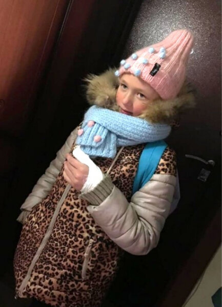 -2